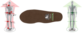 foot levelers picture