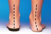 pronated feet